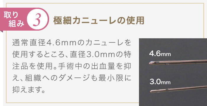 極細カニューレの使用