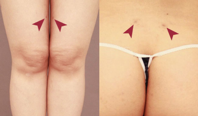 傷跡が大きく残る